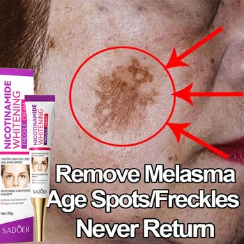 Ниацинамид избелване на място отстраняване комплект лунички крем тъп черен меланин мелазма отстраняване изсветляване на кожата против стареене грижа за лицето